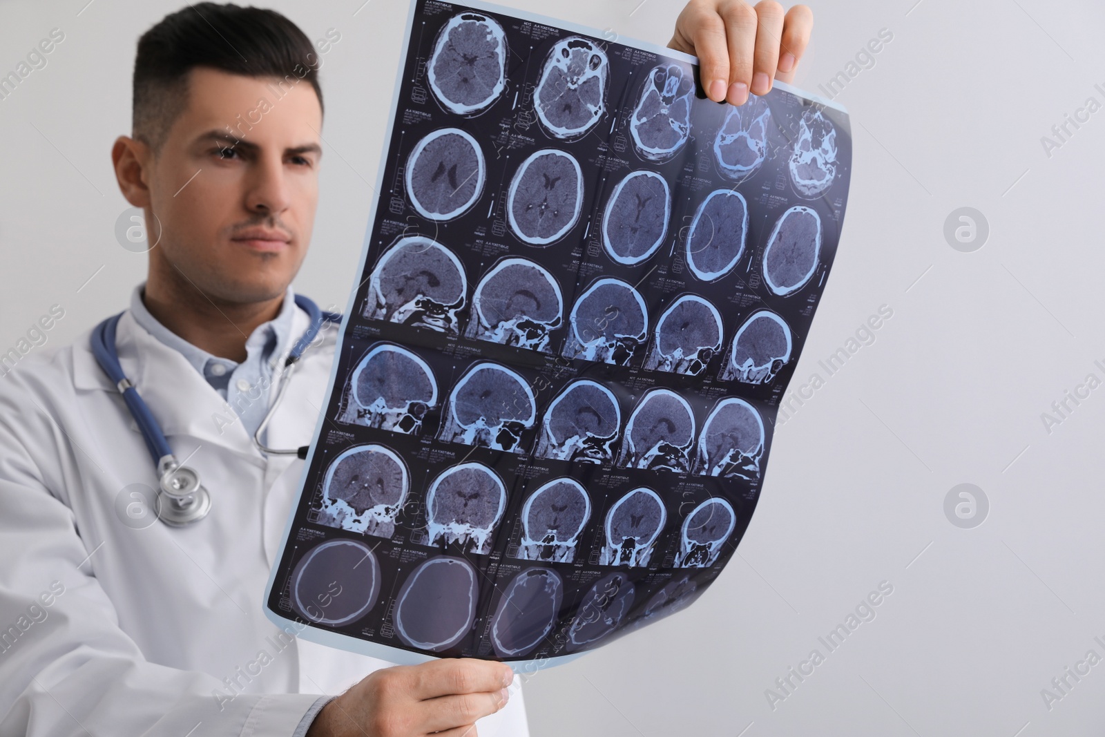 Photo of Doctor examining MRI images of patient with multiple sclerosis in clinic