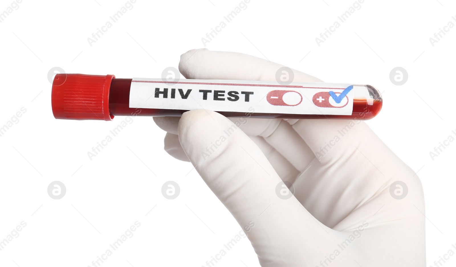 Photo of Scientist holding tube with blood sample and label HIV Test on white background, closeup