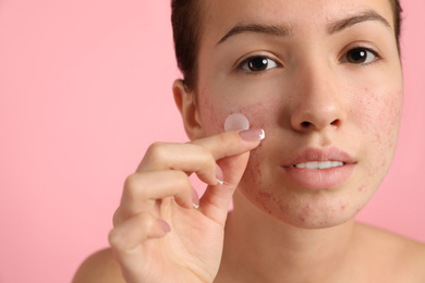 Photo of Teen girl applying acne healing patch on light pink background