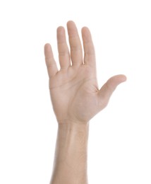 Man showing pale palm on white background, closeup. Anemia symptom