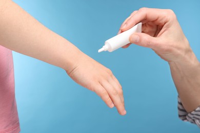 Photo of Mother applying ointment onto her daughter's hand on light blue background, closeup