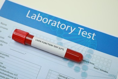 Photo of Liver Function Test. Tube with blood sample and form on white table, above view