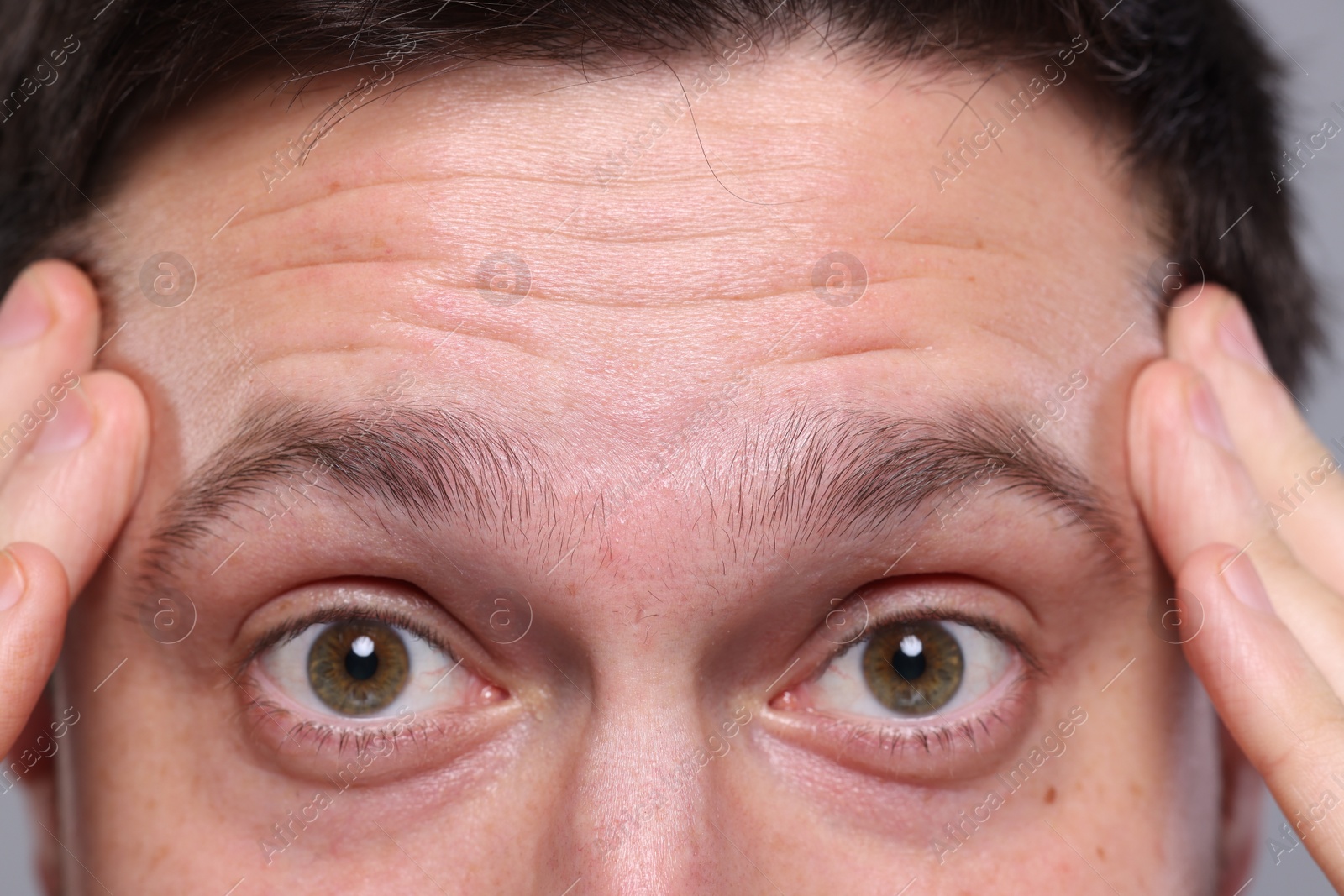 Photo of Closeup view of man with wrinkles on his forehead