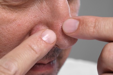 Photo of Man popping pimple on his nose against grey background, closeup