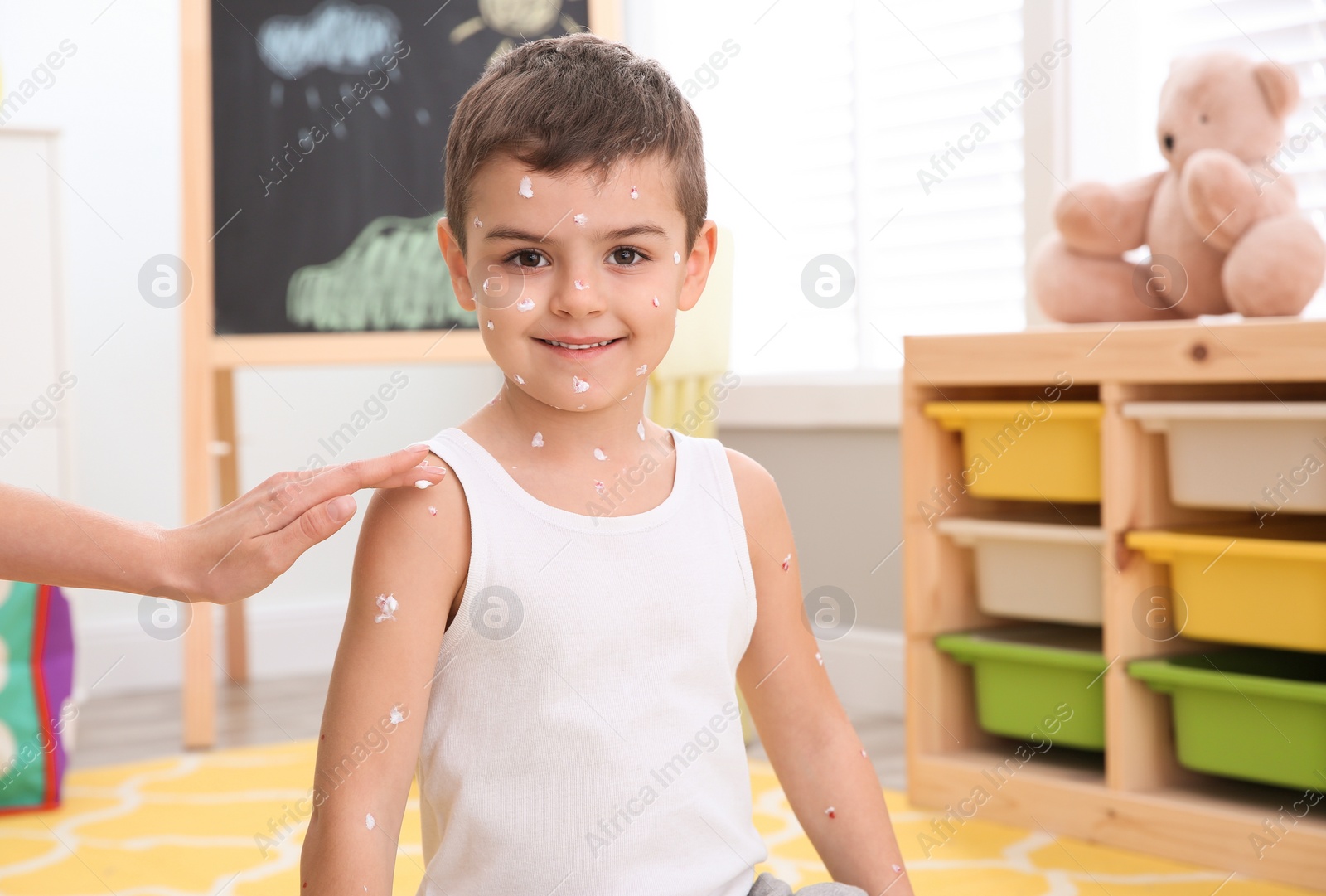 Photo of Woman applying cream onto skin of little boy with chickenpox at home