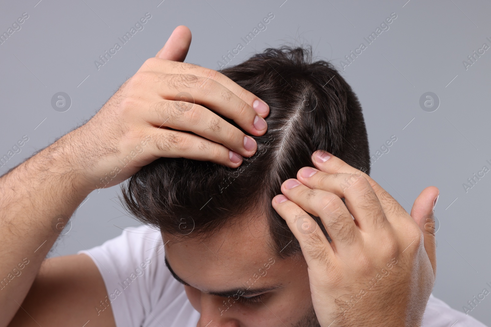 Photo of Man examining his head on light grey background, closeup. Dandruff problem