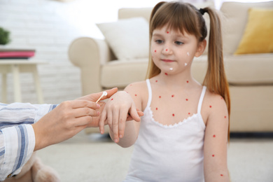 Woman applying cream onto skin of little girl with chickenpox at home