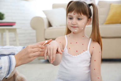 Photo of Woman applying cream onto skin of little girl with chickenpox at home