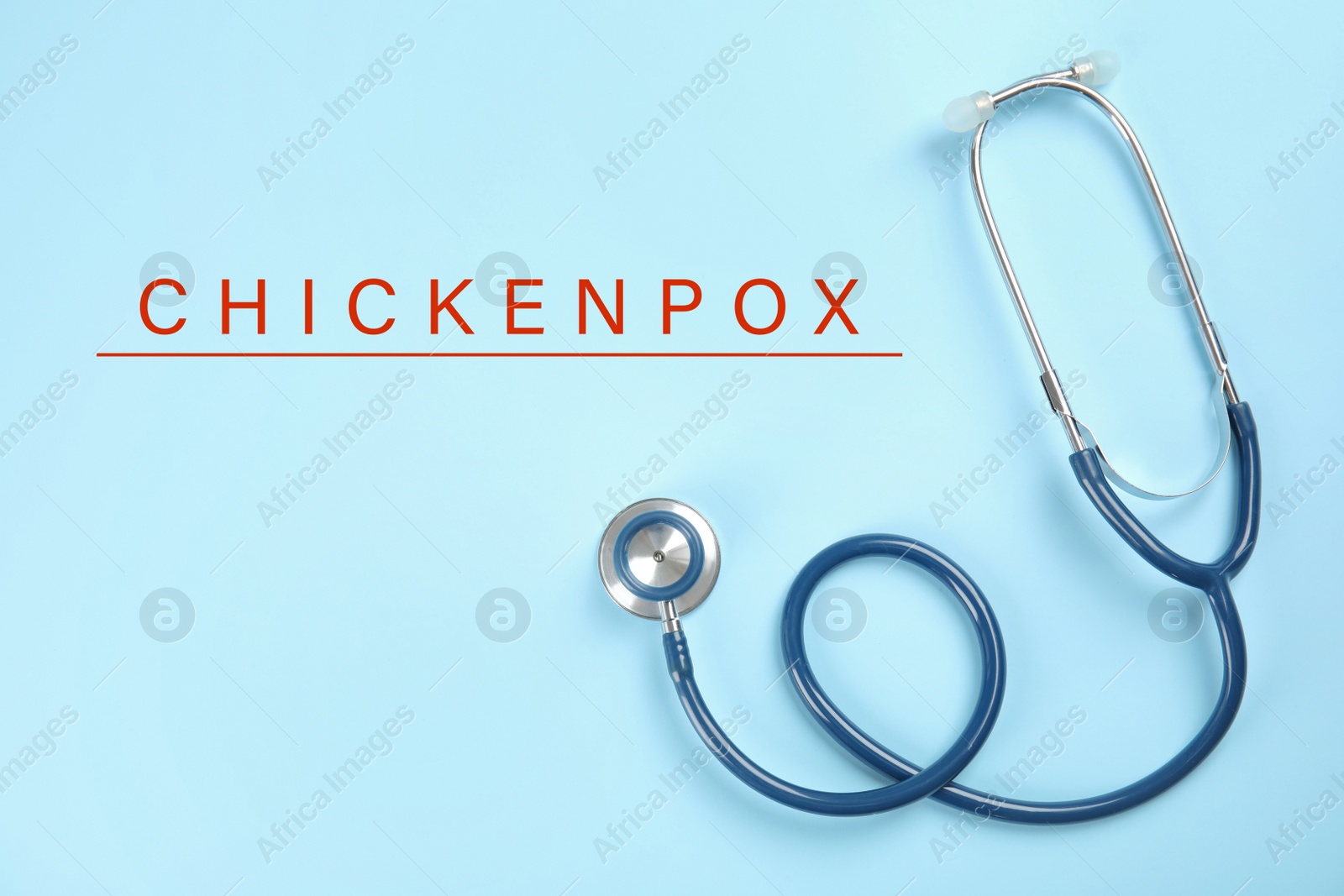 Image of Stethoscope on light blue background, top view. Chickenpox disease 