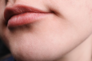 Photo of Woman with dry skin on face, closeup