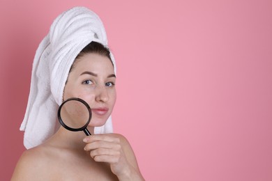 Photo of Young woman with acne problem holding magnifying glass near her skin on pink background. Space for text
