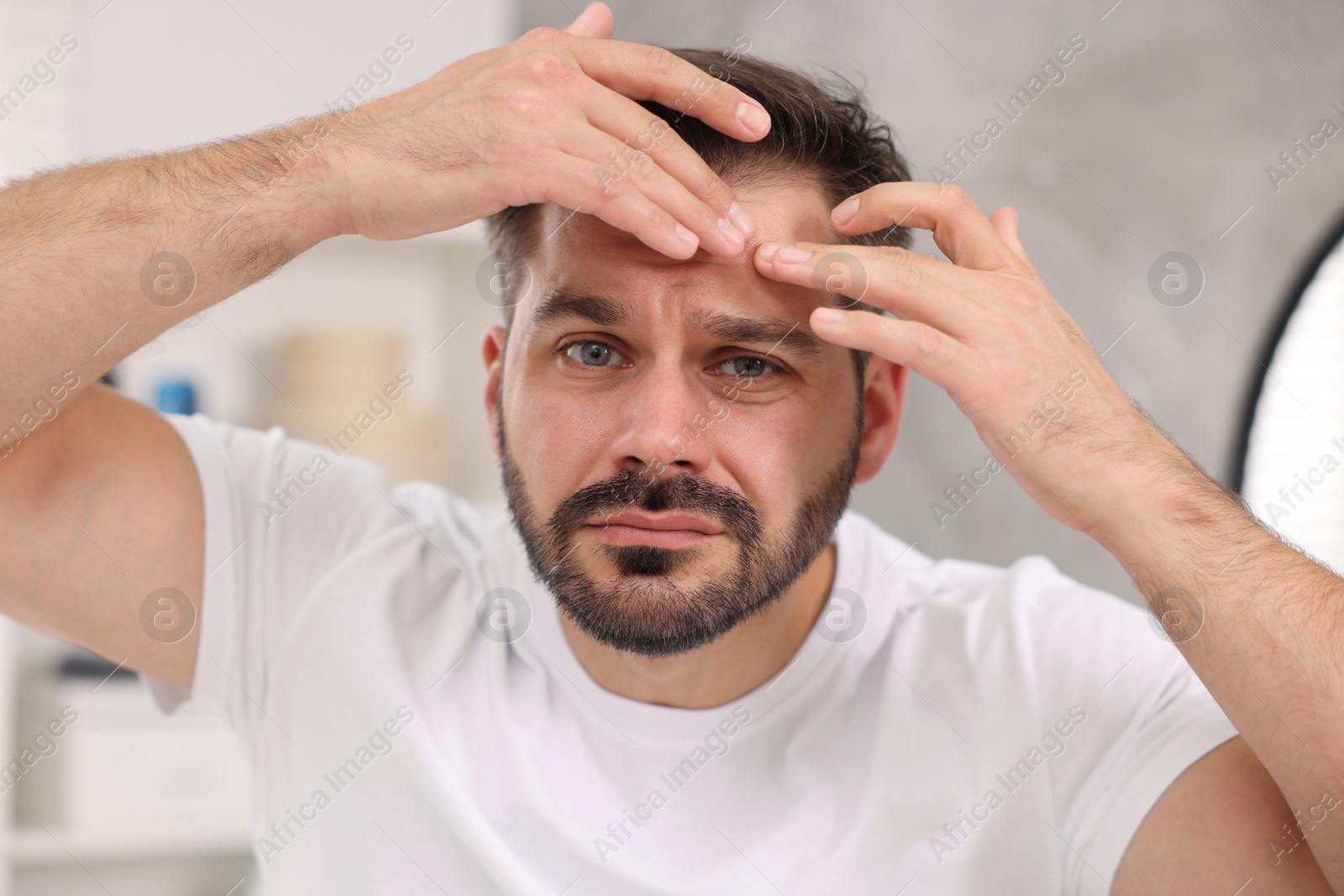 Photo of Skin problem. Confused man touching his face at home