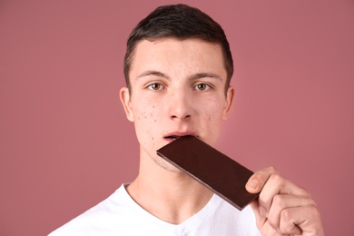 Photo of Young man with acne problem eating chocolate bar on color background. Skin allergy