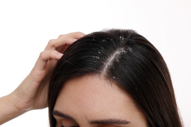 Photo of Woman examining her hair and scalp on white background, closeup. Dandruff problem