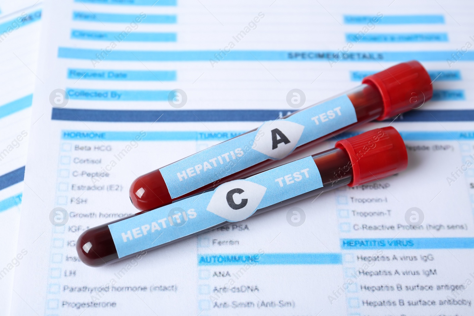 Photo of Tubes with blood samples for hepatitis virus test on laboratory form, closeup