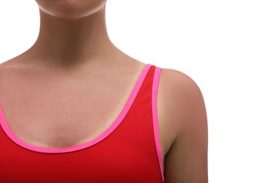 Woman with sunburned skin on white background, closeup