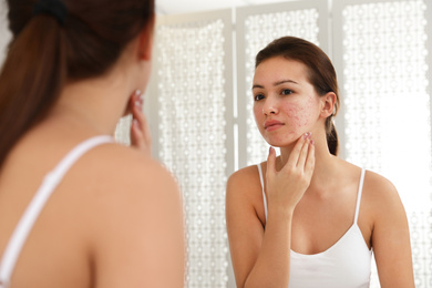 Photo of Teen girl with acne problem near mirror in bathroom