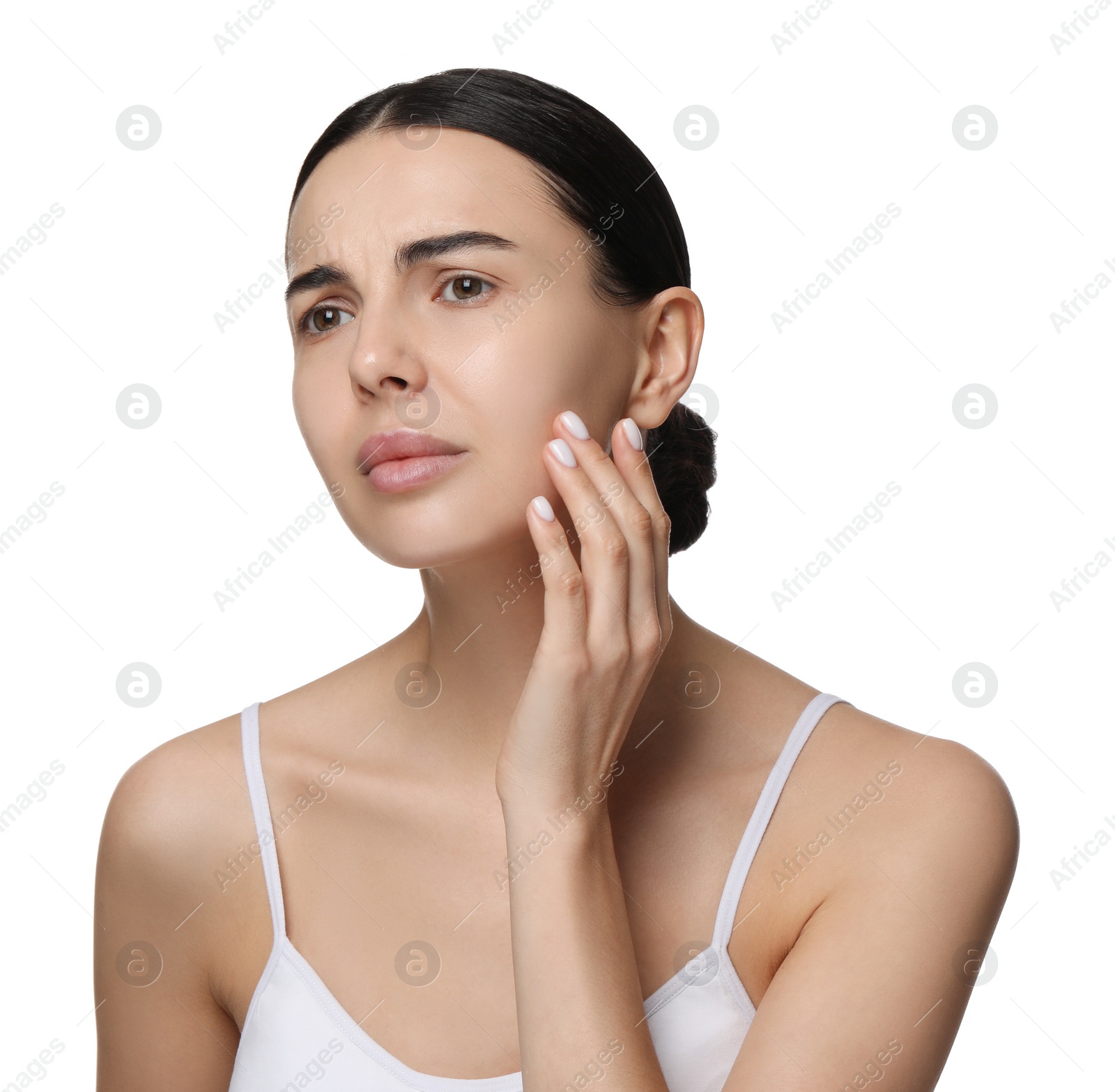 Photo of Young woman with dry skin on white background