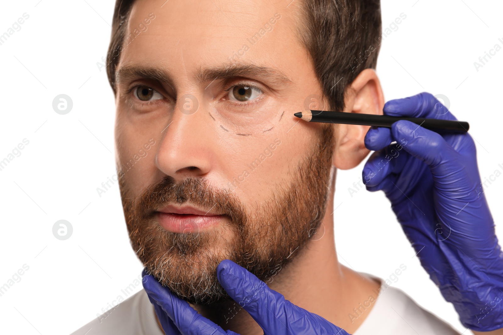 Photo of Doctor with pencil preparing patient for cosmetic surgery operation on white background, closeup