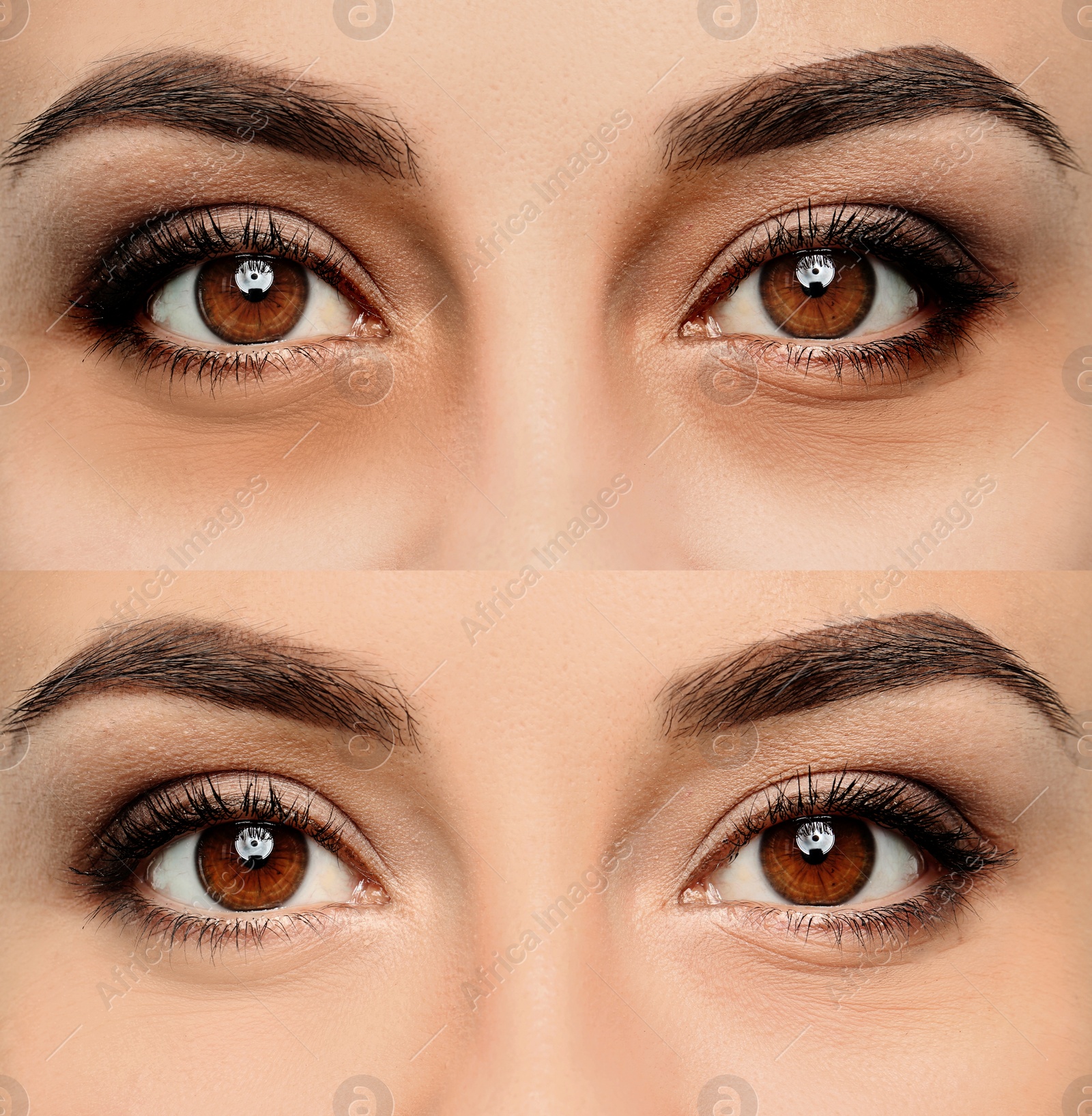 Image of Collage with photos of tired woman with dark circle under eye and after rest, closeup