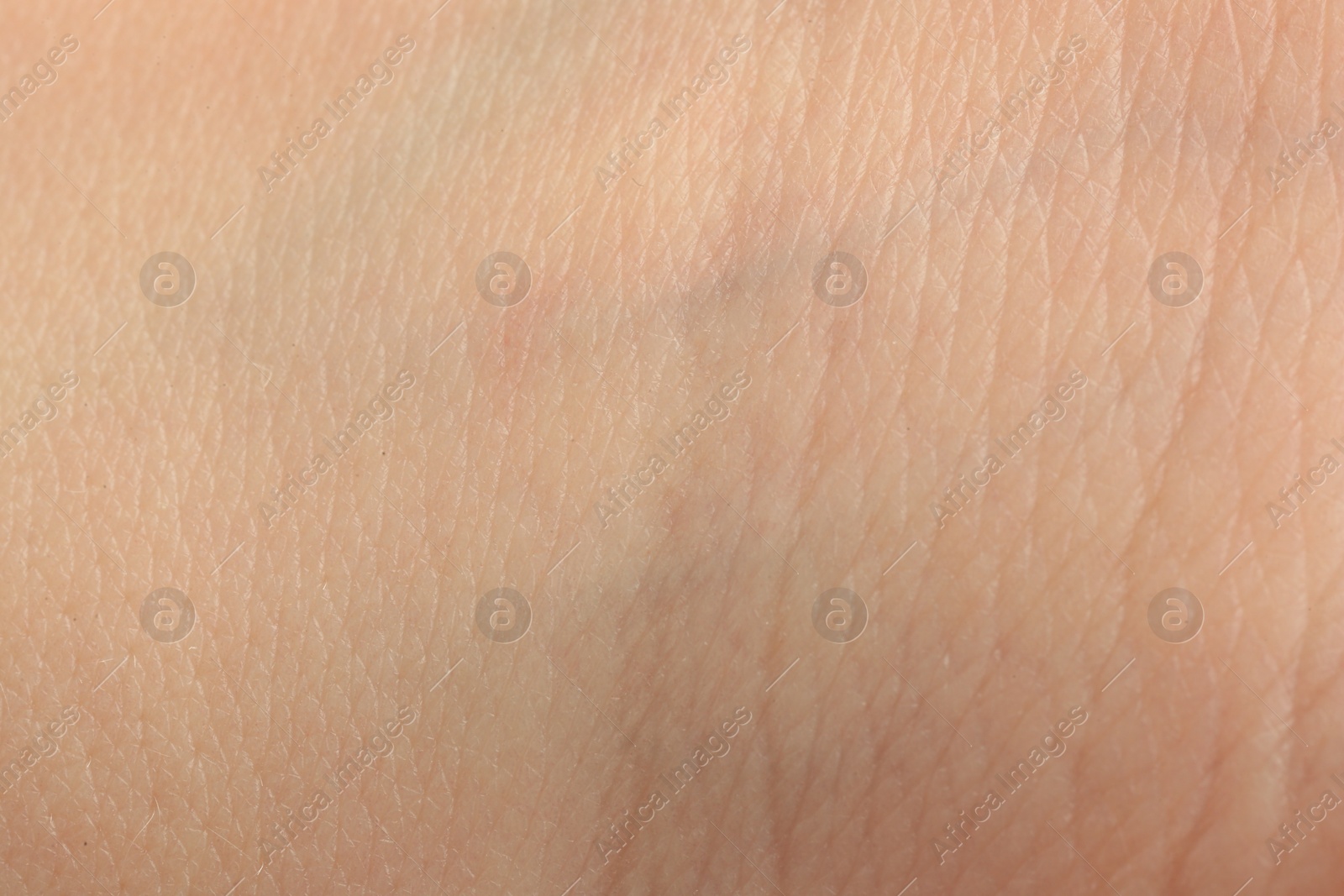 Photo of Texture of dry skin as background, macro view