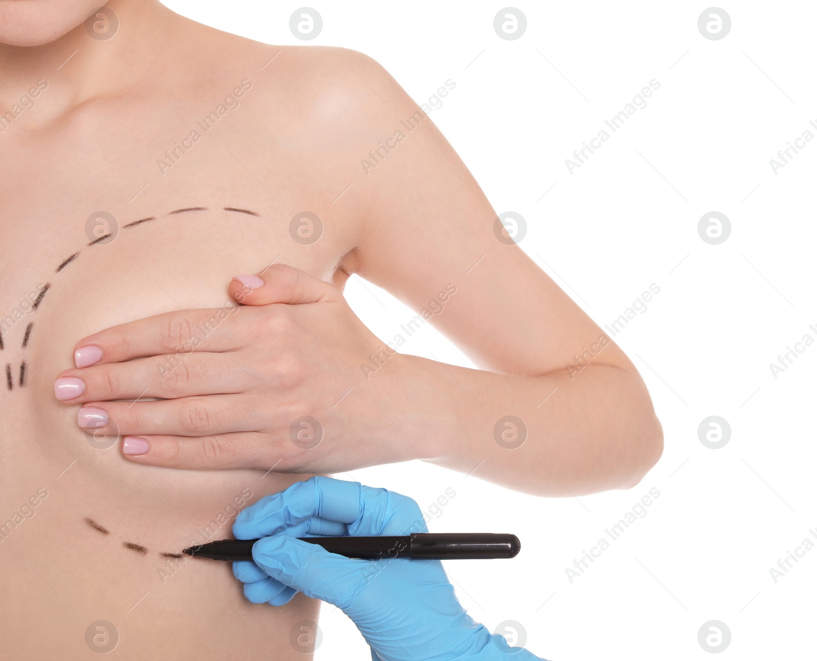 Photo of Doctor drawing marks on female breast for cosmetic surgery operation against white background, closeup