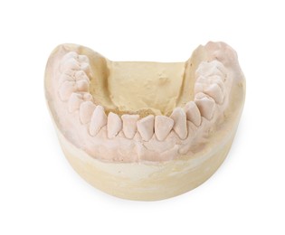 Photo of Dental model with jaw isolated on white. Cast of teeth