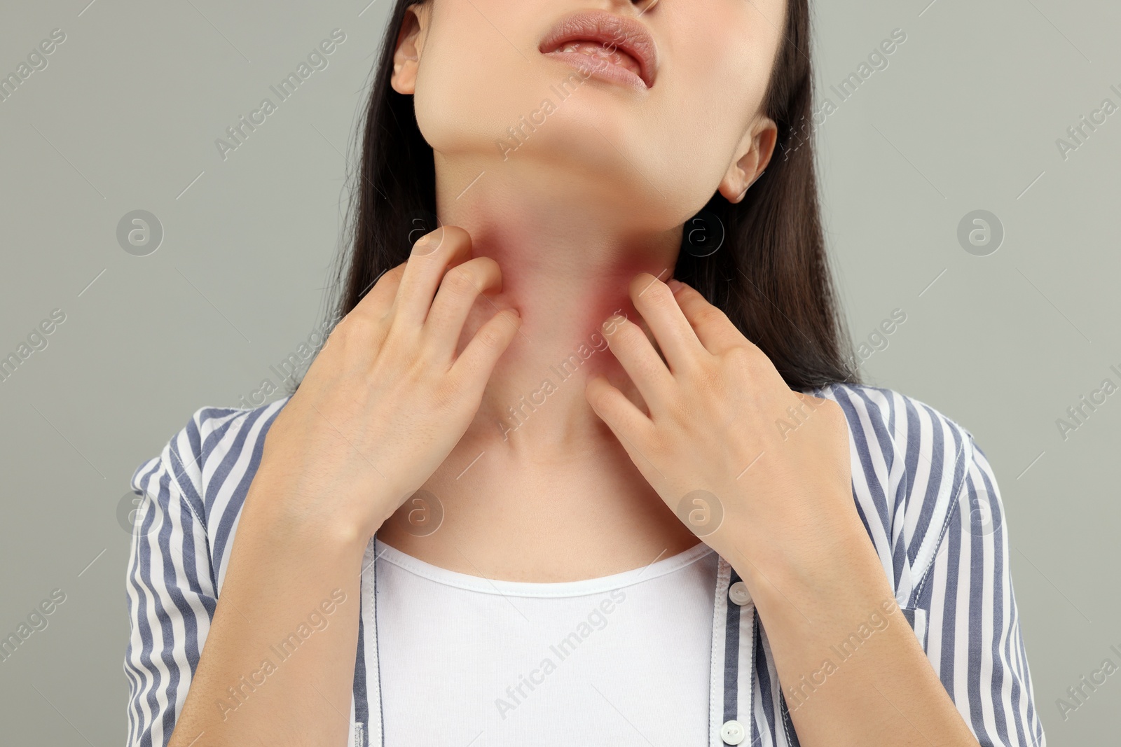 Photo of Suffering from allergy. Young woman scratching her neck on grey background, closeup