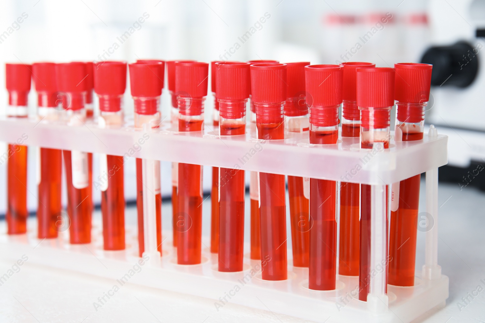 Photo of Test tubes with blood samples on table in laboratory, closeup. Virus research