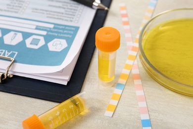 Containers with urine sample for analysis, litmus paper and medical report on table in laboratory