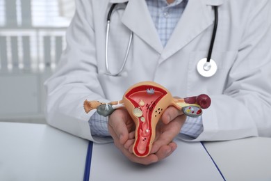 Photo of Gynecologist demonstrating model of female reproductive system in clinic, closeup