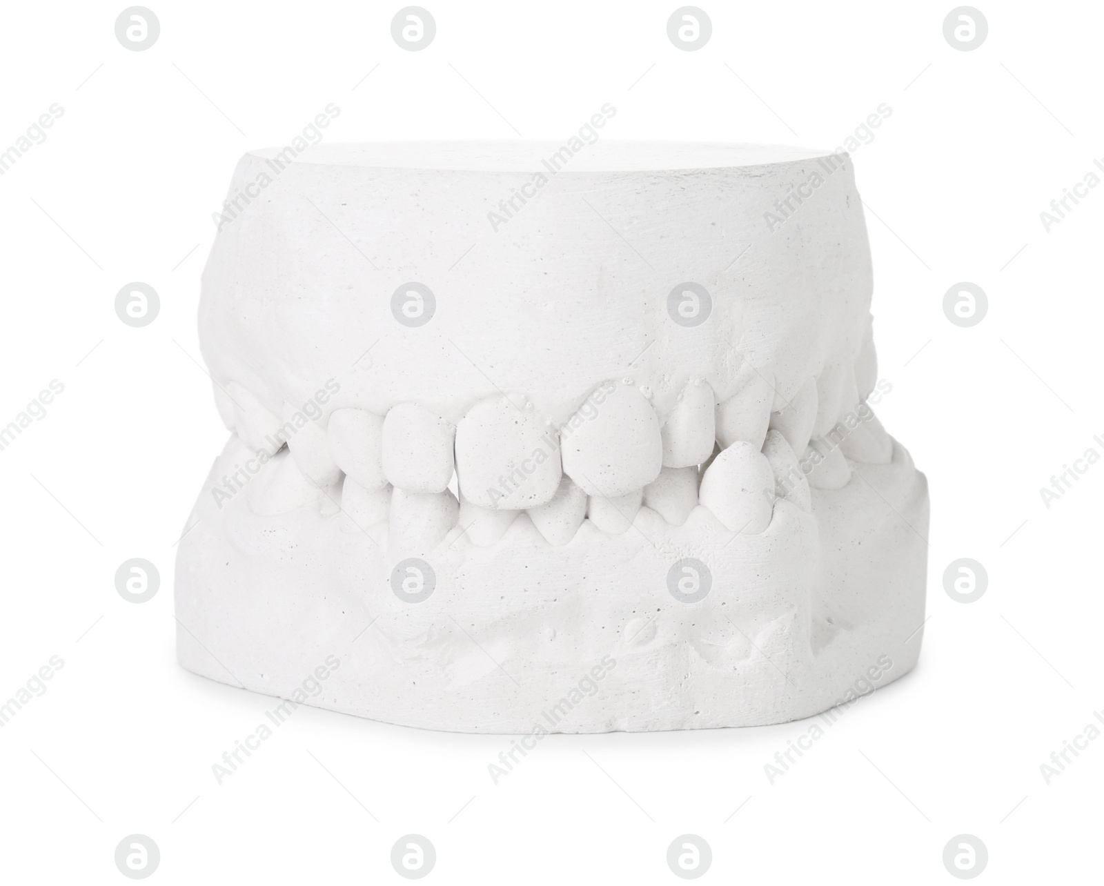 Photo of Dental model with gums isolated on white. Cast of teeth