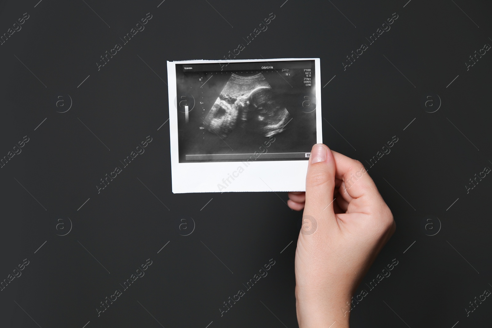 Photo of Woman holding ultrasound picture of baby on black background, closeup