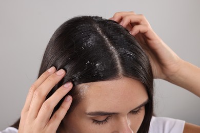 Photo of Woman examining her hair and scalp on grey background, closeup. Dandruff problem
