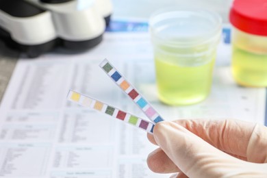 Photo of Doctor holding urine test strips near documents at table, closeup