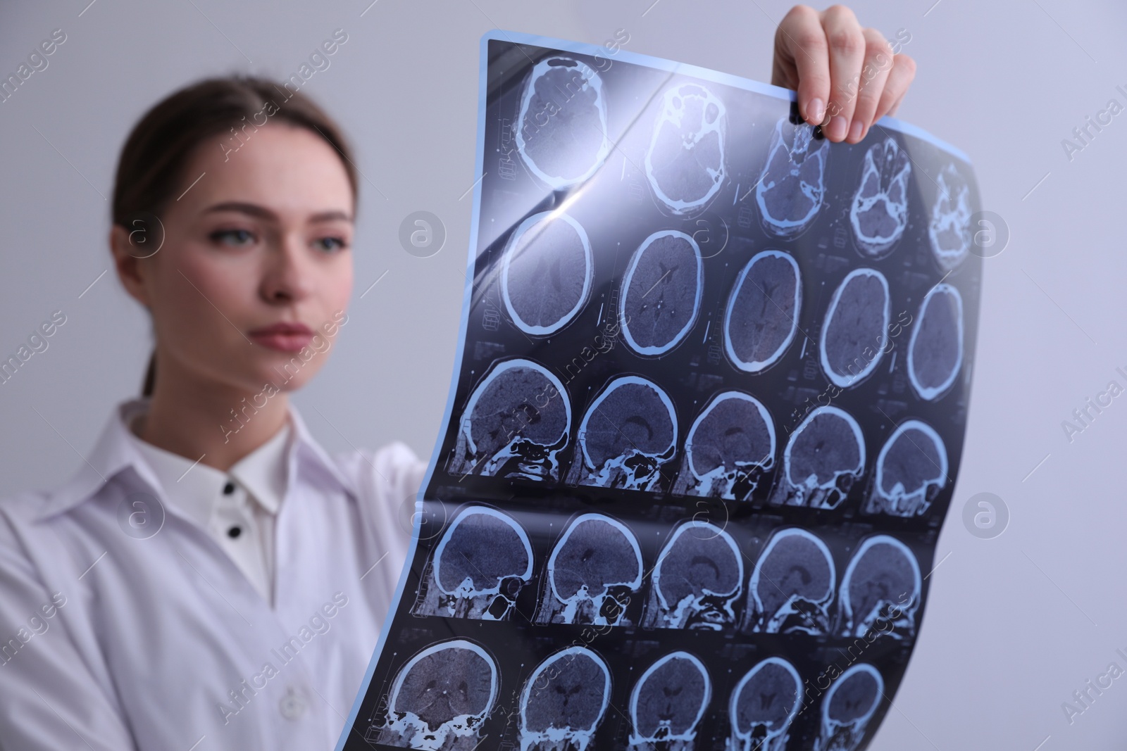 Photo of Doctor examining MRI images of patient with multiple sclerosis in clinic