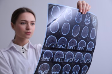Doctor examining MRI images of patient with multiple sclerosis in clinic