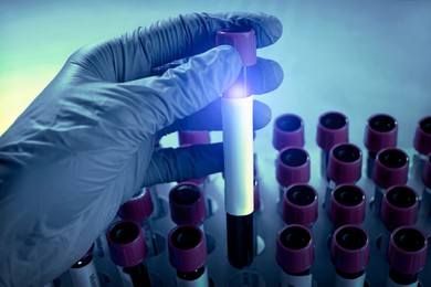 Image of Laboratory worker putting test tube with blood sample into rack, closeup. Color toned
