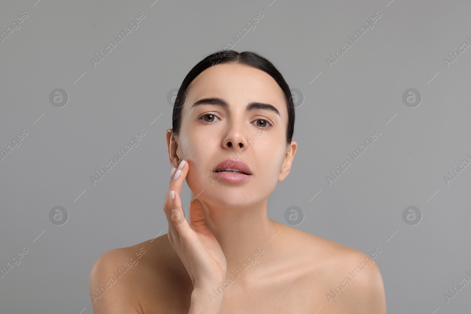 Photo of Young woman with dry skin on gray background