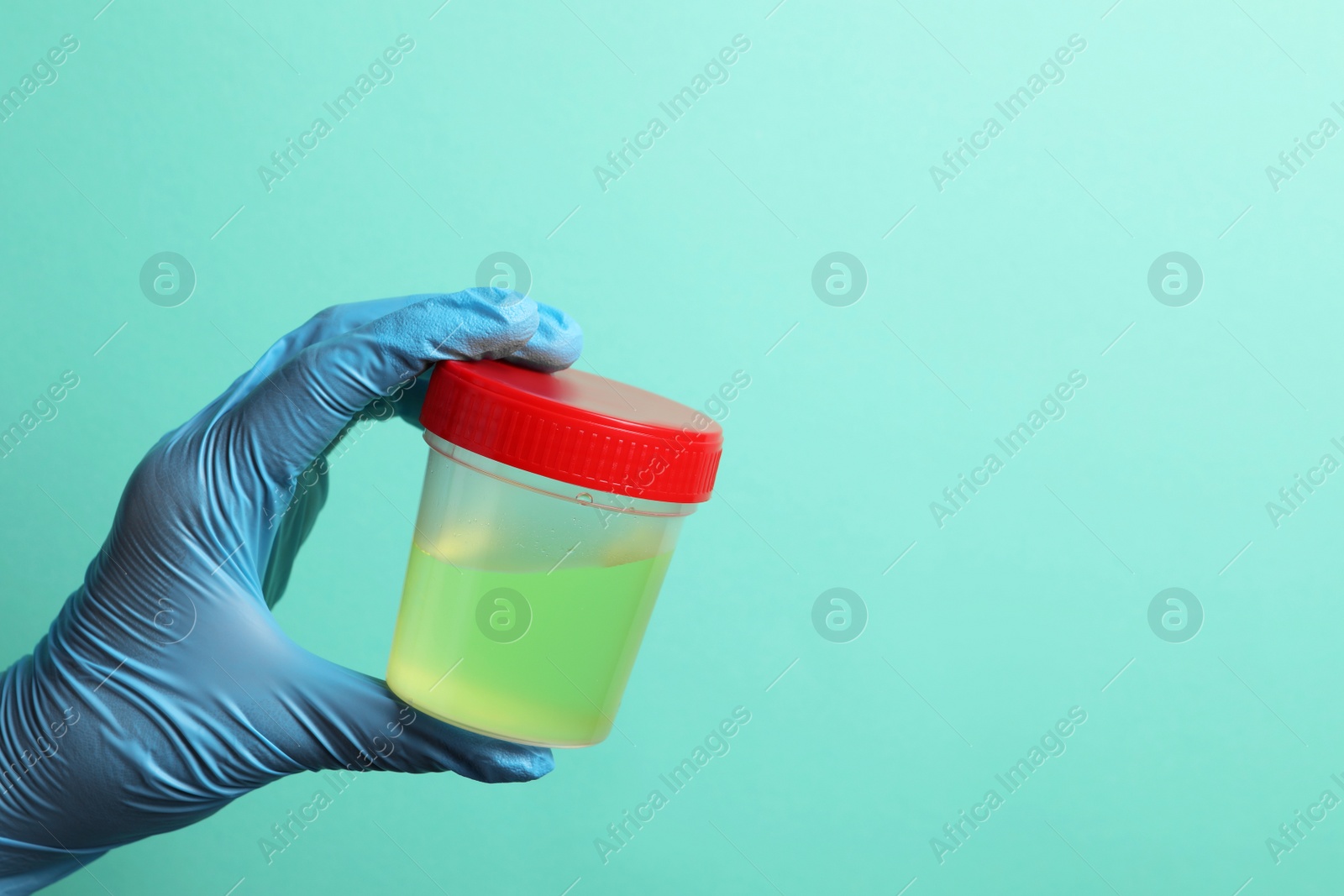 Photo of Doctor holding container with urine sample for analysis on turquoise background, closeup. Space for text