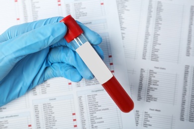 Photo of Doctor holding glass tube with blood sample over documents, closeup. Allergy test