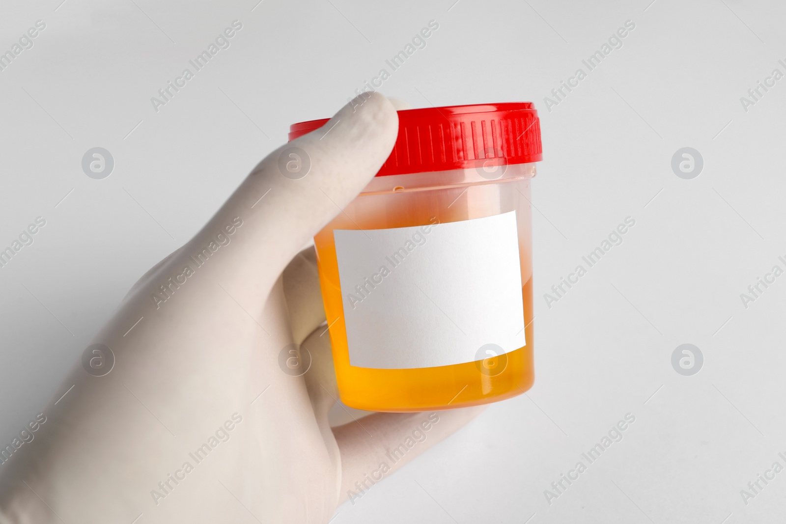 Photo of Nurse holding container with urine sample for analysis on white background, closeup