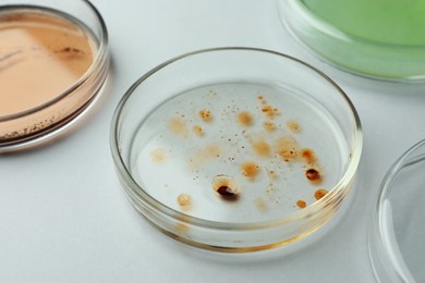Petri dishes with different bacteria colonies on white background, closeup