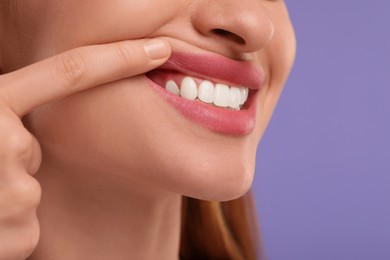 Photo of Woman showing her clean teeth on violet background, closeup. Space for text