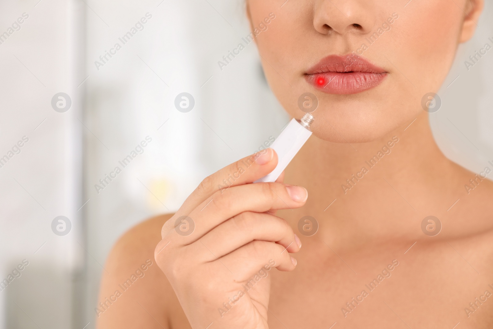 Image of Woman with herpes applying cream onto lip against blurred background, closeup