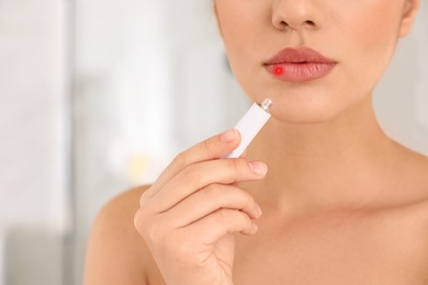 Image of Woman with herpes applying cream onto lip against blurred background, closeup