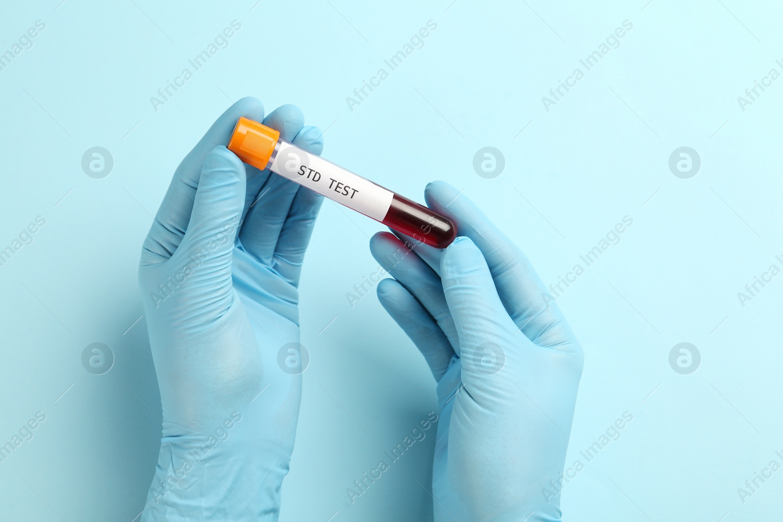 Photo of Scientist holding tube with blood sample and label STD Test on light blue background, top view