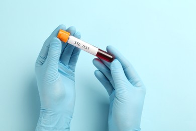 Scientist holding tube with blood sample and label STD Test on light blue background, top view