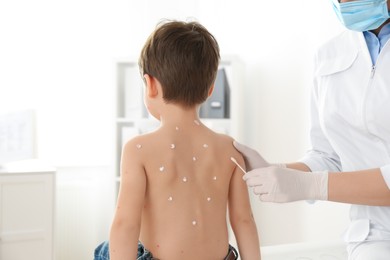 Photo of Doctor applying cream onto skin of little boy with chickenpox in clinic. Varicella zoster virus
