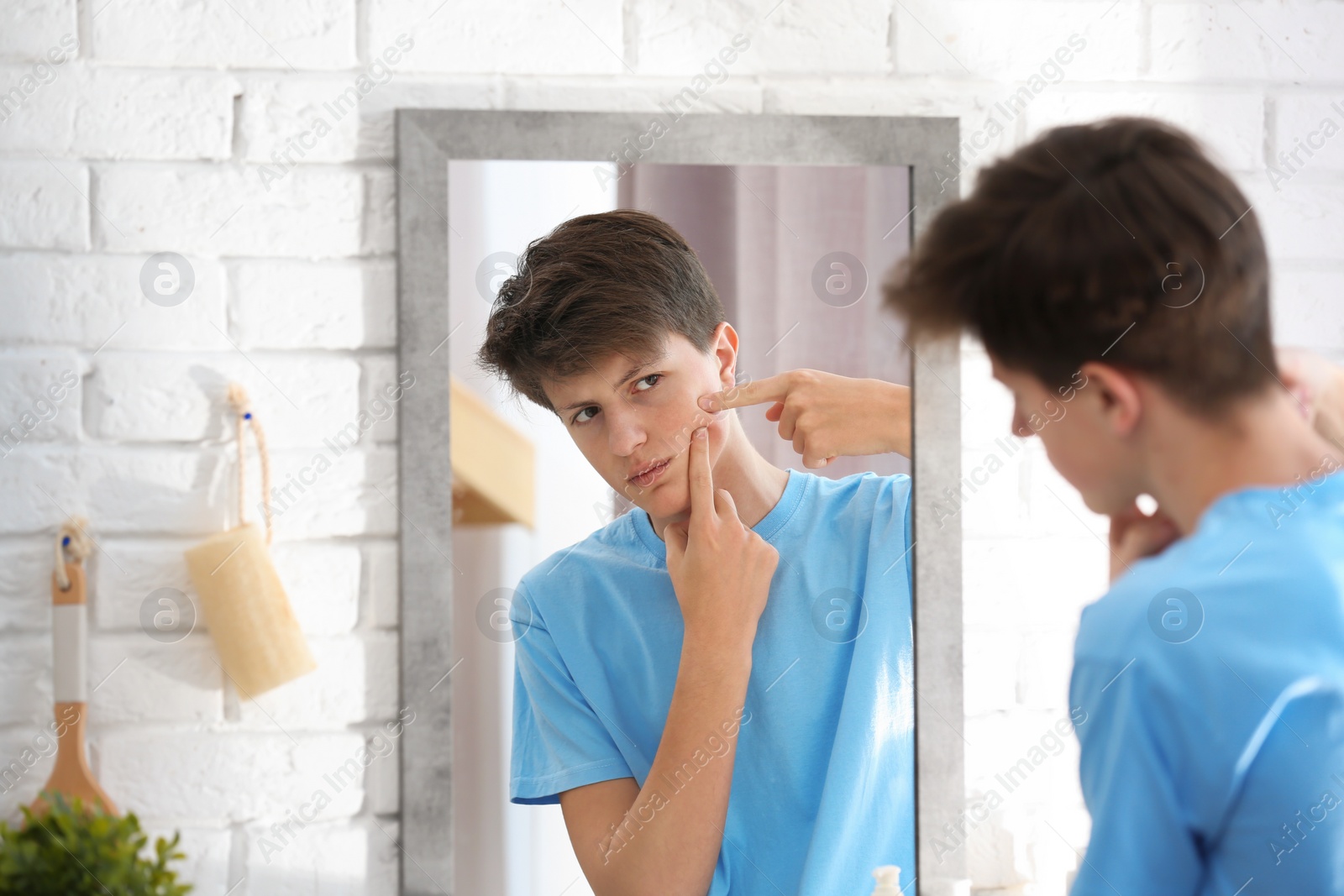 Photo of Teenage boy with acne problem looking in mirror at home